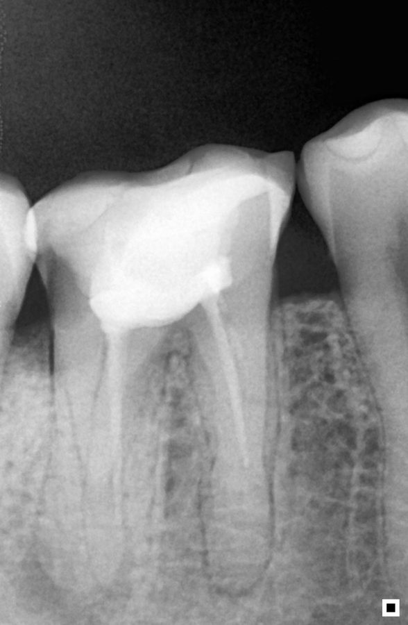 Conductometría molar 4 conductos